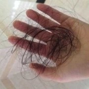 孕期不长头发（头发好象没有发根是为什么）