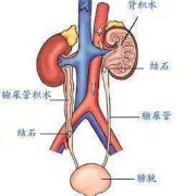 胎儿左肾重复肾畸形怎么办,胎儿肾脏畸形最常见的是