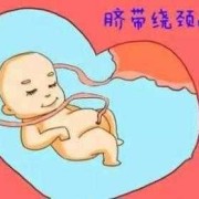 胎儿脐带绕颈三周图片（脐带绕颈三周可以顺产吗）