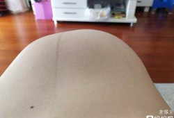 胎动鼓包是胎儿在干嘛（孕25周，胎动频繁，肚子有时候还会鼓包怎么回事）