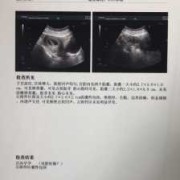 怀孕19周，每次给宝宝测胎心都在肚子左下方，正常吗,怀孕19周胎儿图片欣赏