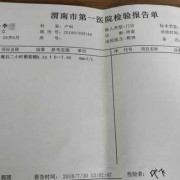 孕期血糖4.8（孕期血糖4.8正常吗）