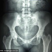 孕期拍片了（孕妇拍了x光怎么办，一次x线对孕早期有什么影响）