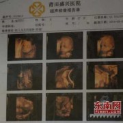怀孕六个月胎儿彩超（怀孕六个月胎儿彩超视频）