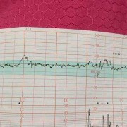 孕38周宫缩频繁胎动多是不是表示小孩快要生了?这段时间需要注意什么呢,b超频繁对胎儿的影响大吗