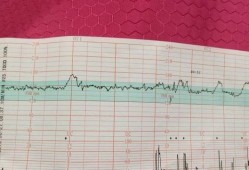 孕38周宫缩频繁胎动多是不是表示小孩快要生了?这段时间需要注意什么呢,b超频繁对胎儿的影响大吗