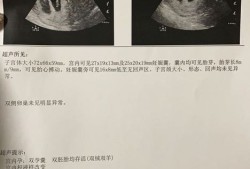 孕7周胎儿真实图（孕11周双顶径1.7孩子大，还是小）