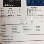 hl是胎儿的什么（彩超单上的BPD、HC、AC、FL分别指什么）