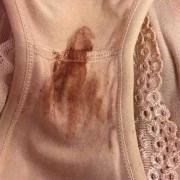 怀孕期间出血肚子不疼（怀孕期间出血肚子不疼是什么情况）