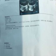 11周胎心167正常吗,胎儿心跳167次正常吗