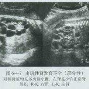 胎儿多囊肾是什么原因造成的（胎儿多囊肾会不会慢慢变好）