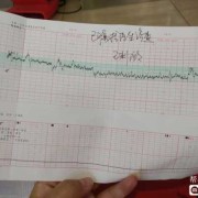 怀孕几周有胎心，有了胎心就表示胎儿发育很好了吗,胎儿发育快好不好