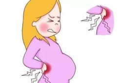 备孕期腰痛（备孕期腰痛）