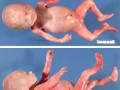 怀孕8周胎儿图片（胎儿胎心快是什么原因造成的啊？孕八个月多了，要做什么检查好）