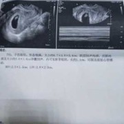 七周的宝宝为什么老闹脾气,怀孕七周胎儿图片欣赏 彩超