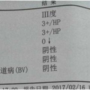 检查是否怀孕挂什么科?检查什么项目,孕期妇科检查清洁度三度是什么意思