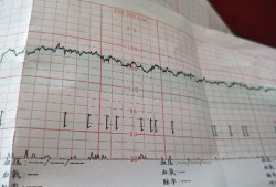 孕33周胎儿缺氧的表现是什么呢？谁知道呢,彩超能看出胎儿缺氧吗