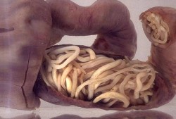 胎儿寄生虫（一岁宝宝肚子里的虫是什么虫）