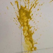 怀孕后大便就很多了是怎么回事,孕期屎特别多老放屁正常吗