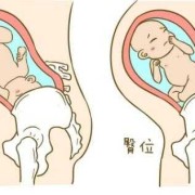 胎儿打嗝的位置（胎儿打嗝的位置是头还是哪个部位）