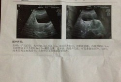 孕期附件疼（怀孕了右侧附件区囊肿怎么办）