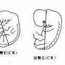 胎儿顶臀经（臀顶长是指什么）