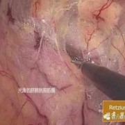 腹壁裂胎儿图片（蜘蛛腹部裂了一个口子如何挽救呀）