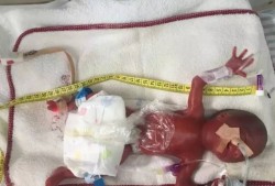 胎儿死图片（人为什么都要死呢？如果早晚都会死，那活着还有什么意义呢）