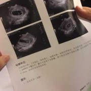 胎儿6周（胎儿6周有胎心了吗）
