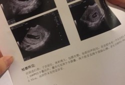 胎儿6周（胎儿6周有胎心了吗）
