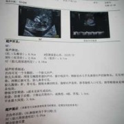 胎儿nt检查是什么（nt检查是什么?孕期做nt检查是检查什么项目呢）