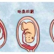 胎儿孕前壁（胎儿怀前壁）