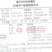 胎儿鼻骨正常值（如何看懂nt检查报告单）