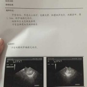 孕期两周（怀孕两周出血怎么办）