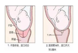 预产期到了，宫颈不软化应该怎么办呢,孕期宫颈软是什么意思