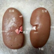 猪肾的结构名称,胎儿肾椎体肿胀怎么办