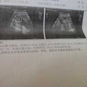 胎儿十六周有多大（怀孕16周胎心多少正常）