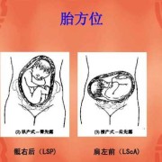 左骶前位胎儿图片（胎位左骶前是什么位置）