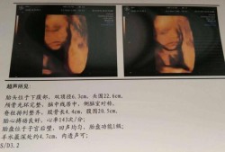 怀孕7个月可以做四维彩超吗,胎儿7个月四维彩超图片