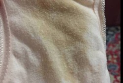 孕期小便发黄怎么回事（我怀孕以后的内裤上总发黄是怎么回事）