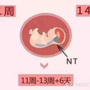 孕期畸形检查（孕期畸形检查什么时候）