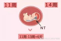 孕期畸形检查（孕期畸形检查什么时候）