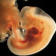 怀孕50天胎芽多大正常？大家有知道的吗,孕五十天胎儿图片