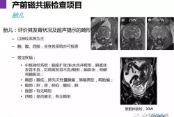 核磁对胎儿有影响吗（核磁共振对怀孕有影响吗）