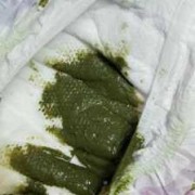 3个月的宝宝大便绿色黏黏的果冻状是怎么回事,3个月胎儿图片