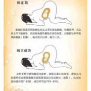 胎位是LSA怎么办,如何改变胎儿体位姿势