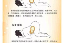 胎位是LSA怎么办,如何改变胎儿体位姿势