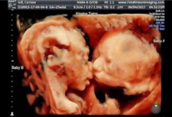 怀孕32周胎儿腹中视频（手机存储卡的视频无法播放）