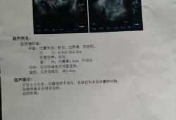 盆腔积液影响胎儿发育吗（盆腔积液影响胎儿发育吗女性）