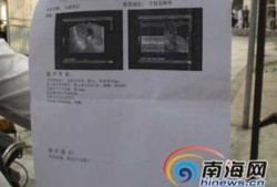 孕五个月胎儿多重正常呢？怀孕五个月胎儿2.5斤正常吗,怎么估算胎儿体重公式